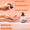 100% Pure Manuka Oil from New Zealand Therapeutic Grade Essential Oil for Wound Care Skin Soothing Nail & Scalp Health Organic Undiluted Cold Pressed
